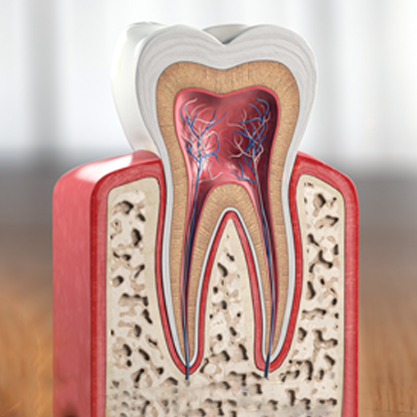 Root Canal Treatment in Madurai