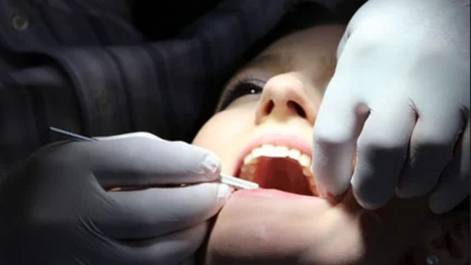 Painless Dental Treatment in Madurai | Laser Dental Treatment in Madurai